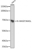 N-WASP/WASL Rabbit mAb (A2270)