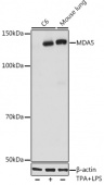 MDA5 Rabbit mAb (A2419)