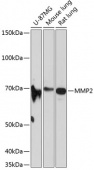 MMP2 Rabbit mAb (A19080)