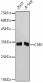 CBR1 Rabbit mAb (A19263)