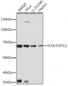 TCF4/TCF7L2 Rabbit mAb (A19548)