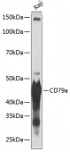 CD79a Rabbit mAb (A19024)