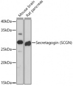Secretagogin (SCGN) Rabbit mAb (A19615)