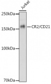 CR2/CD21 Rabbit mAb (A1267)