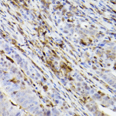 Ferritin Heavy Chain Rabbit mAb (A22439)