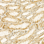 CYP24A1 Rabbit mAb (A22615)