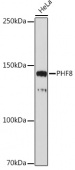 PHF8 Rabbit mAb (A19780)