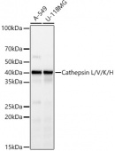 Cathepsin L Rabbit mAb (A23375)