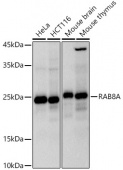 RAB8A Rabbit mAb (A20976)