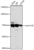 Lamin B2 Rabbit mAb (A5001)