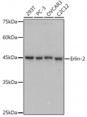 Erlin-2 Rabbit mAb (A0781)