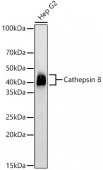 Cathepsin B Rabbit mAb (A23039)
