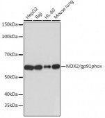 NOX2/gp91phox Rabbit mAb (A19701)