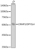 CRMP3/DPYSL4 Rabbit mAb (A0624)