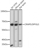 CRMP5/DPYSL5 Rabbit mAb (A3503)