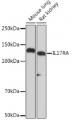 IL17RA Rabbit mAb (A5163)
