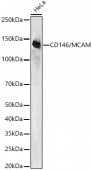 CD146/MCAM Rabbit mAb (A22195)