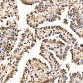 GLI2 Rabbit mAb (A23094)