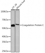 Coagulation Protein C Rabbit mAb (A4532)