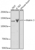 Matrin 3 Rabbit mAb (A1027)