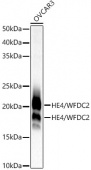 HE4/WFDC2 Rabbit mAb (A21953)