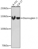Desmoglein 3 Rabbit mAb (A5227)