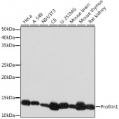 Profilin1 Rabbit mAb (A9188)