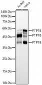 PTP1B Rabbit mAb (A23035)