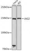 JAG2 Rabbit mAb (A19267)