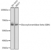 Glucosylceramidase beta (GBA) Rabbit mAb (A19057)