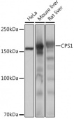 CPS1 Rabbit mAb (A4214)