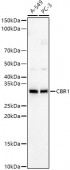 CBR1 Rabbit mAb (A23568)