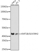 KMT1B / SUV39H2 Rabbit mAb (A3705)