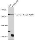Mannose Receptor/CD206 Rabbit mAb (A11192)