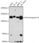 Chromogranin B Rabbit mAb (A3517)