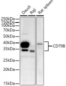 CD79B Rabbit mAb (A4362)