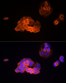 MMP13 Rabbit mAb (A22334)