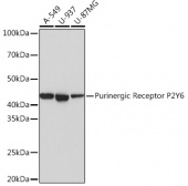 Purinergic Receptor P2Y6 Rabbit mAb (A3708)