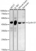 Cyclin E1 Rabbit PolymAb® (A22476)
