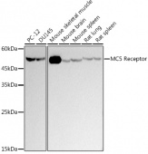 MC5 Receptor Rabbit mAb (A9331)