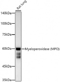 Myeloperoxidase (MPO) Mouse mAb (A20748)
