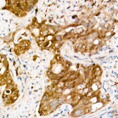 SOD1 Rabbit mAb (A21211)