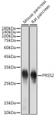 PRSS2 Rabbit mAb (A19275)