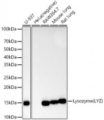 Lysozyme (LYZ) Rabbit mAb (A10972)