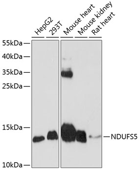 A1265_NDUFS5_WB.jpg