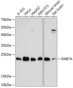 A12784_RAB7A_WB.jpg