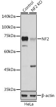 A13626_2.jpg
