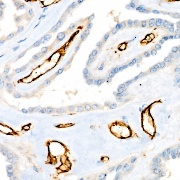 A19014_5.jpg