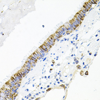 A1981_2.jpg