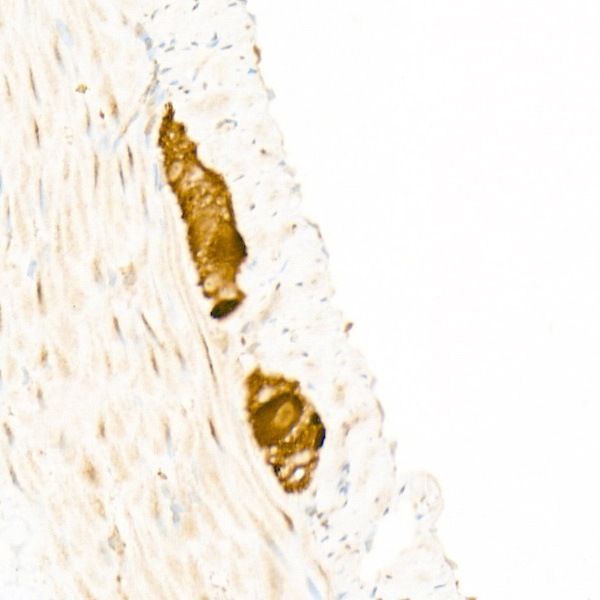 A22611_4.jpg